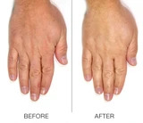 2 IN 1 HAND & NAIL TREATMENT 4